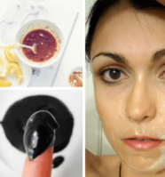 Banish Blemishes with these 13 Natural Face Masks for Acne